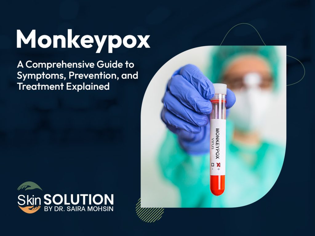 monkey pox treatment and awareness