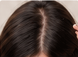 Hair loss treatment and scalp consultation