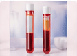 PRP treatment for skin and hair concerns